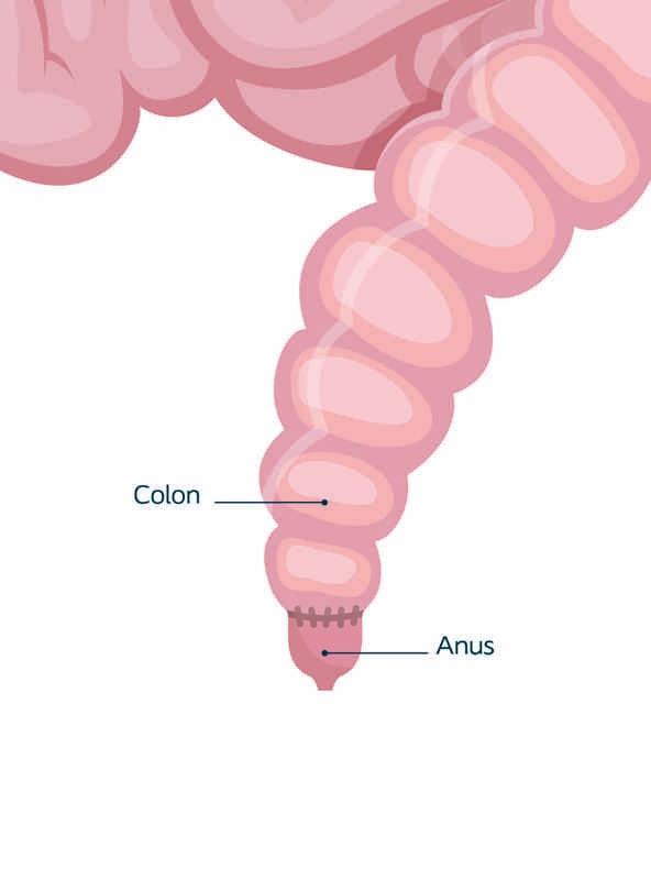 Kolon-anus